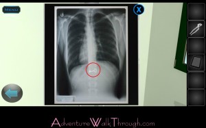 Lets Escape Stage7 Chest X-ray